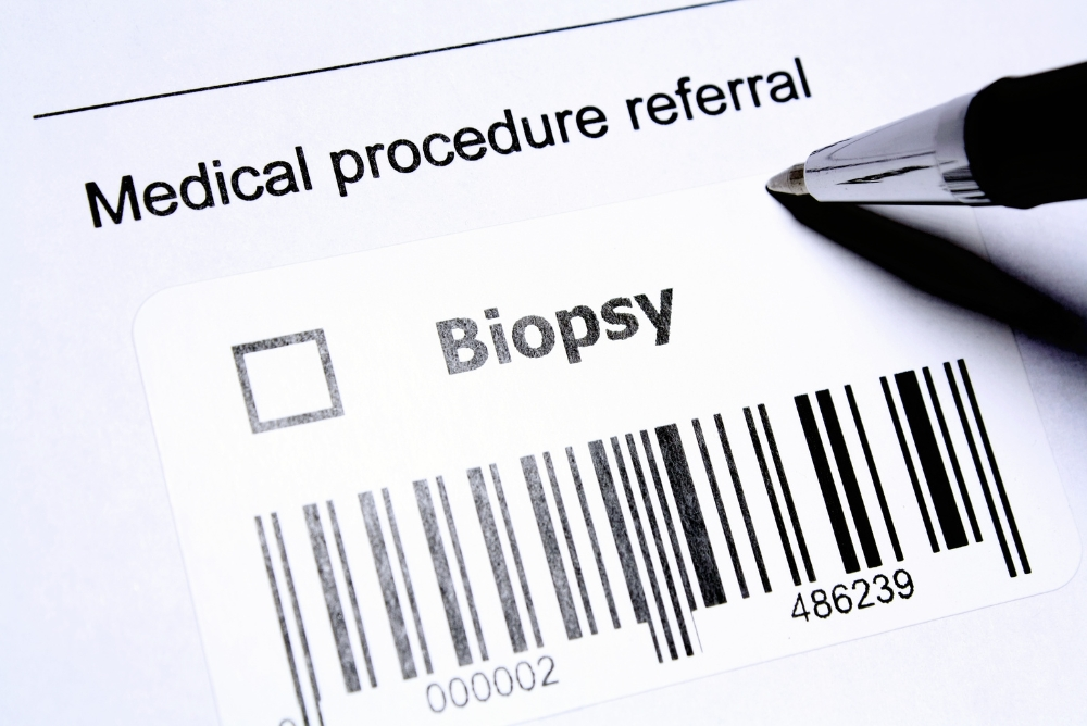 When Do Doctors Recommend FNAC and Biopsy